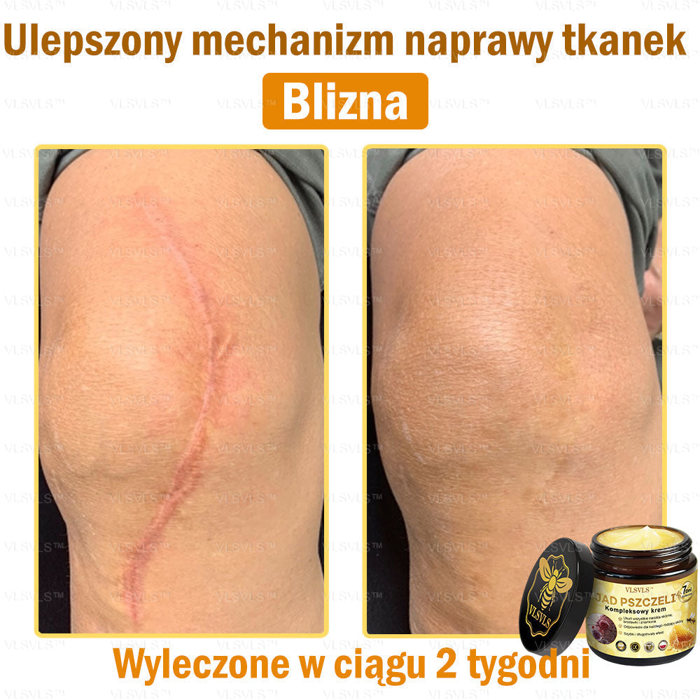 VLSVLS™ Krem Komprehensywny z Jadami Pszczół 🇺🇸 Rekomendowany przez Dermatologów