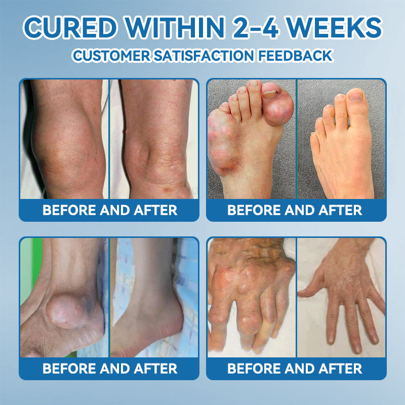 𝖯𝗂𝖼𝗱𝗈® BPC-157 Krem regenerujący stawy 🦴 Skutecznie łagodzi artretyzm, neuropatię, reumatyzm, kontuzje sportowe i wiele więcej 👍