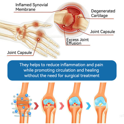 𝖯𝗂𝖼𝗱𝗈® BPC-157 Krem regenerujący stawy 🦴 Skutecznie łagodzi artretyzm, neuropatię, reumatyzm, kontuzje sportowe i wiele więcej 👍