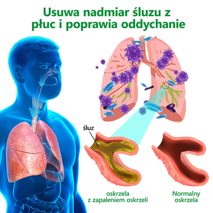 𝑳𝒆𝒓𝒄𝒆𝒂™💖𝐾𝑟𝑒𝑚 𝑟𝑒𝑔𝑒𝑛𝑒𝑟𝑢𝑗ą𝑐𝑦 𝑝ł𝑢𝑐𝑎 𝑧 𝑑𝑧𝑖𝑒𝑤𝑎𝑛𝑛𝑦 - 𝑍𝑎𝑡𝑤𝑖𝑒𝑟𝑑𝑧𝑜𝑛𝑦 𝑝𝑟𝑧𝑒𝑧 𝑃𝑜𝑙𝑠𝑘𝑖𝑒 𝑇𝑜𝑤𝑎𝑟𝑧𝑦𝑠𝑡𝑤𝑜 𝐶ℎ𝑜𝑟ó𝑏 𝐾𝑙𝑎𝑡𝑘𝑖 𝑃𝑖𝑒𝑟𝑠𝑖𝑜𝑤𝑒𝑗 𝑤 𝑐𝑒𝑙𝑢 𝑤𝑠𝑝𝑖𝑒𝑟𝑎𝑛𝑖𝑎 𝑧𝑑𝑟𝑜𝑤𝑖𝑎 𝑝ł𝑢𝑐 𝑥