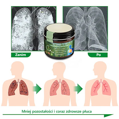 𝑳𝒆𝒓𝒄𝒆𝒂™💖𝐾𝑟𝑒𝑚 𝑟𝑒𝑔𝑒𝑛𝑒𝑟𝑢𝑗ą𝑐𝑦 𝑝ł𝑢𝑐𝑎 𝑧 𝑑𝑧𝑖𝑒𝑤𝑎𝑛𝑛𝑦 - 𝑍𝑎𝑡𝑤𝑖𝑒𝑟𝑑𝑧𝑜𝑛𝑦 𝑝𝑟𝑧𝑒𝑧 𝑃𝑜𝑙𝑠𝑘𝑖𝑒 𝑇𝑜𝑤𝑎𝑟𝑧𝑦𝑠𝑡𝑤𝑜 𝐶ℎ𝑜𝑟ó𝑏 𝐾𝑙𝑎𝑡𝑘𝑖 𝑃𝑖𝑒𝑟𝑠𝑖𝑜𝑤𝑒𝑗 𝑤 𝑐𝑒𝑙𝑢 𝑤𝑠𝑝𝑖𝑒𝑟𝑎𝑛𝑖𝑎 𝑧𝑑𝑟𝑜𝑤𝑖𝑎 𝑝ł𝑢𝑐 𝑥