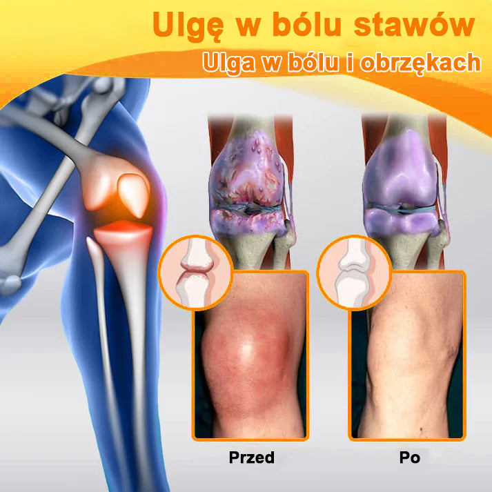 ✅Oficjalny sklep: Ouryard™ Olej magnezowy i miód w sprayu do naprawy stawów👨‍⚕️Zatwierdzony przez Polską Agencję Leków, Wyrobów Medycznych i Produktów Biologicznych (URPL)🔥🔥