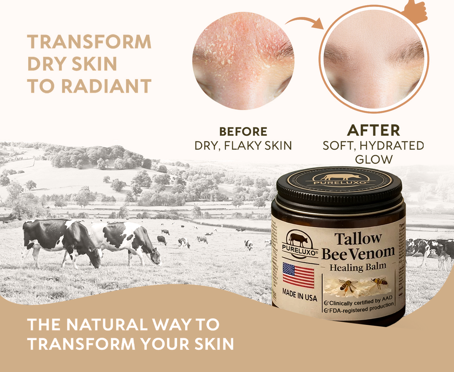 【Kojący】70% kojący】Nadaje się do skóry trądzikowej, zmarszczkowej i uszkodzonej (bez sterydów)