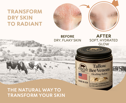 【Kojący】70% kojący】Nadaje się do skóry trądzikowej, zmarszczkowej i uszkodzonej (bez sterydów)