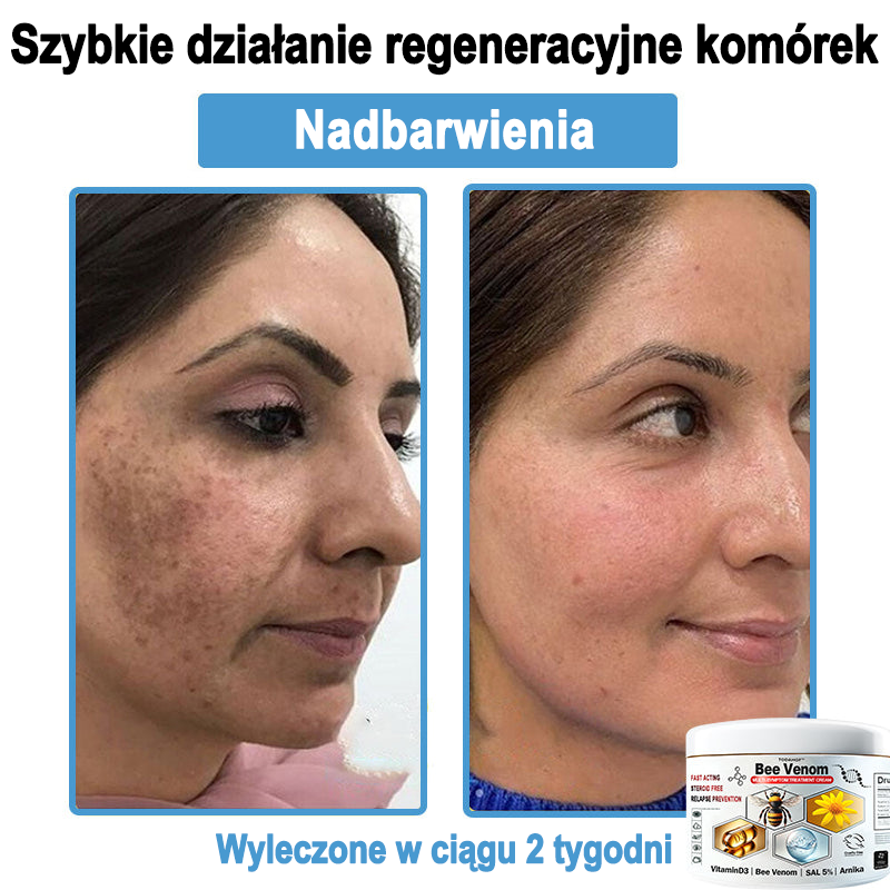 TOD𝐀HOF™🥑 Krem do wielosymptomowej pielęgnacji skóry z jadem pszczelim (ACDRECOMMENDS)