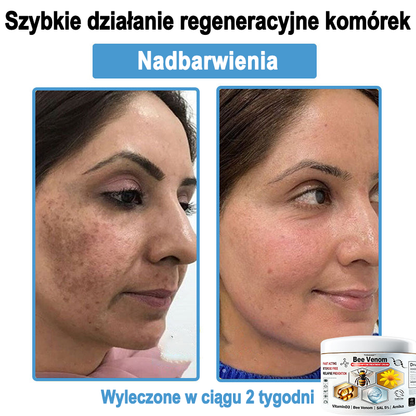 TOD𝐀HOF™🥑 Krem do wielosymptomowej pielęgnacji skóry z jadem pszczelim (ACDRECOMMENDS)