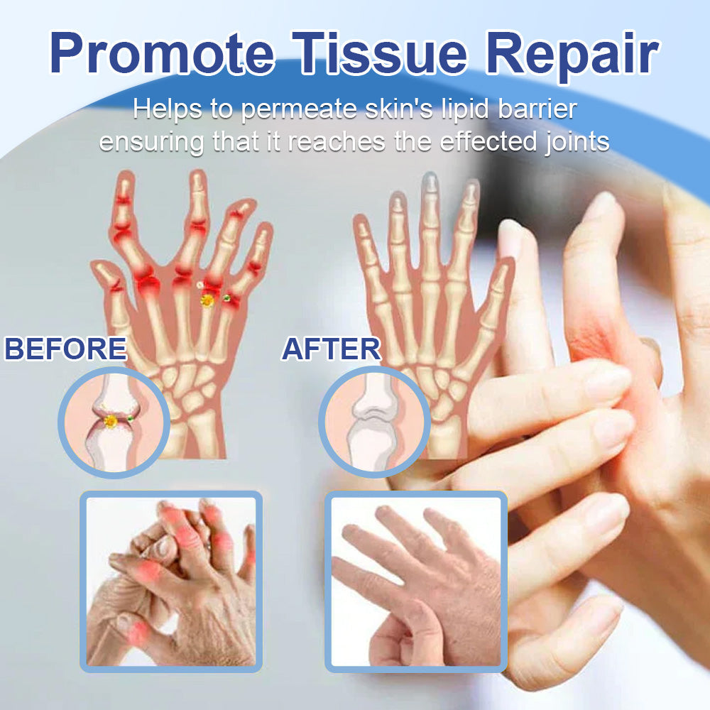 ✅Mayo Clinic Official: Ourlyard® Magnesium Pain Healing Bone Cream (leczenie zapalenia stawów, neuropatii, chorób reumatycznych, skurczów mięśni, drgawek i urazów sportowych)