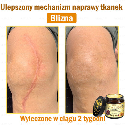 VLSVLS™ Krem Komprehensywny z Jadami Pszczół 🇺🇸 Rekomendowany przez Dermatologów