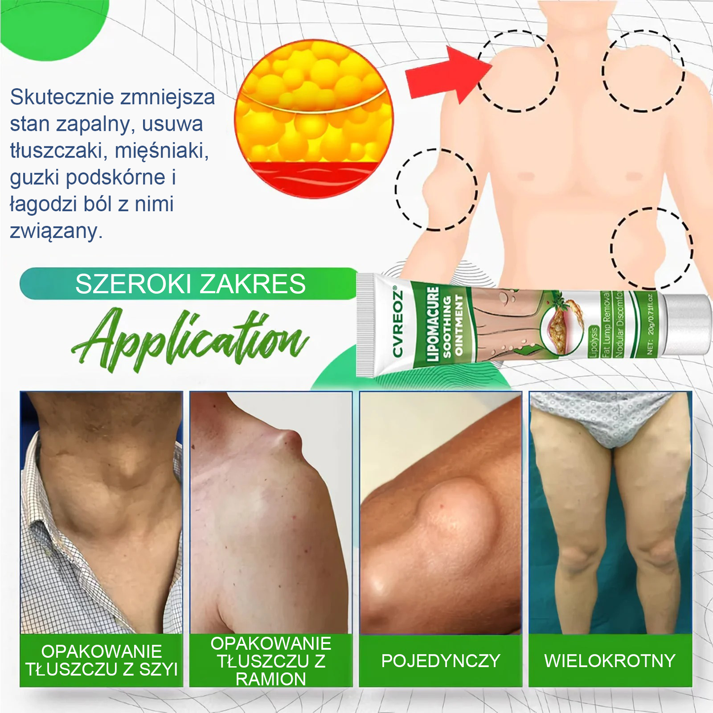 Maść łagodząca Cvreoz® Lipoma Cure