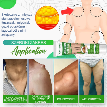 Maść łagodząca Cvreoz® Lipoma Cure
