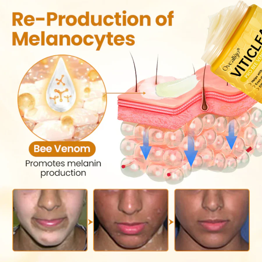 Krem z jadem pszczelim Oveallgo® VitiClear Pro