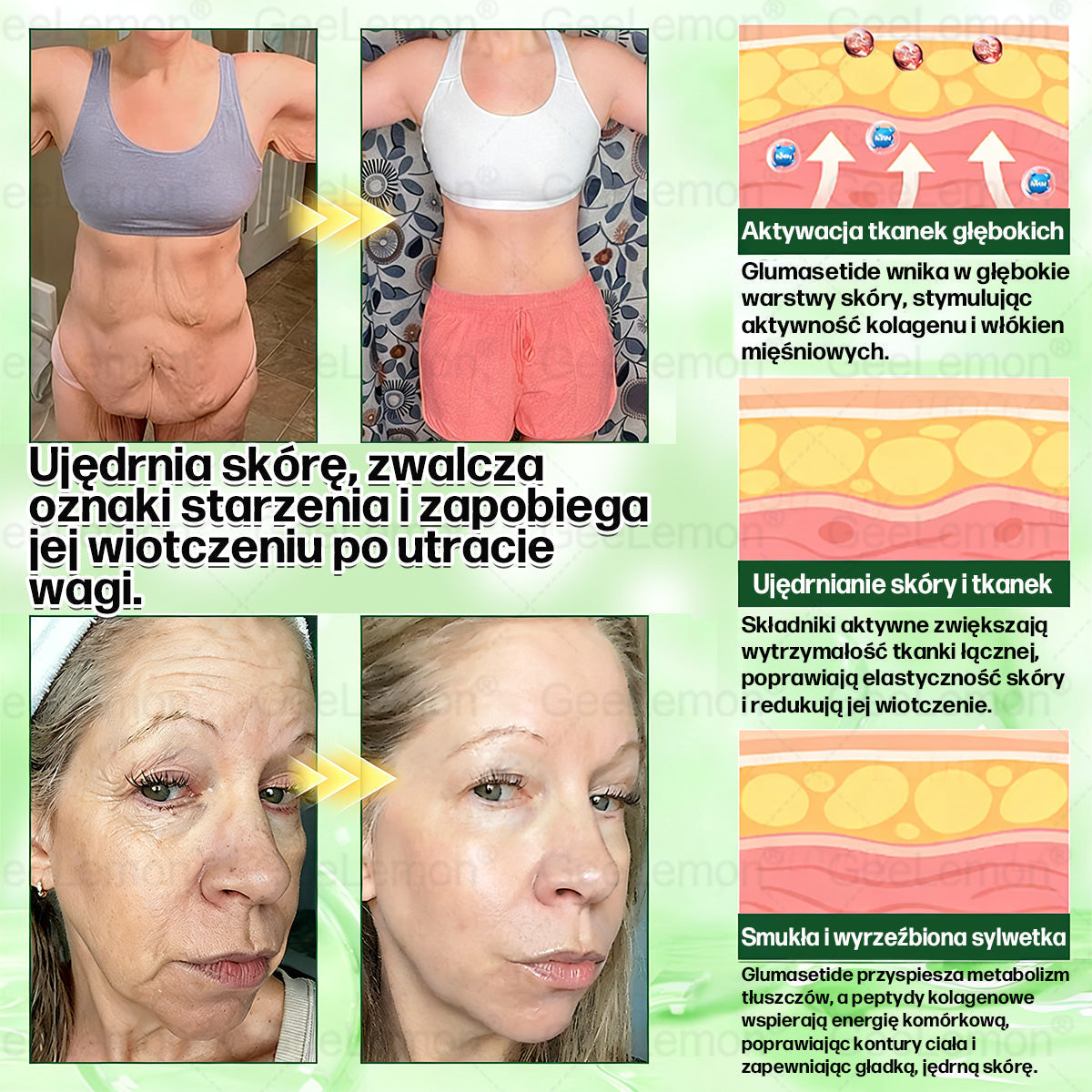 👩‍⚕️Oficjalny Sklep | 🎁 Pureluxo® 𝐆𝐥𝐮𝐦ase𝐭𝐢𝐝𝐞 𝟖 𝐰 𝟏 Smukły i Zdrowy Nano Plaster z Mikronakłuciami 🇵🇱(Tylko raz dziennie, widoczne zmiany już w 7 dni)✅ Na otyłość, 🅛🅞🅞🅢🅔 🅢🅚🅘🅝 wiotką skórę, cukrzycę, bezdech senny, problemy ze stawami i wiele więcej🎅🎄🎄🎄