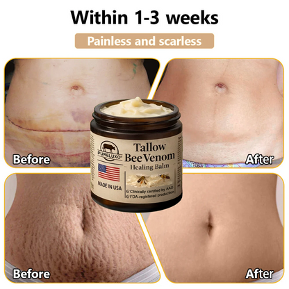 【Kojący】70% kojący】Nadaje się do skóry trądzikowej, zmarszczkowej i uszkodzonej (bez sterydów)