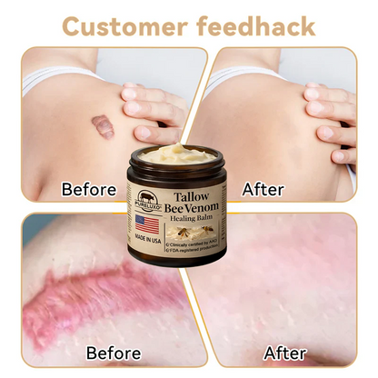 【Kojący】70% kojący】Nadaje się do skóry trądzikowej, zmarszczkowej i uszkodzonej (bez sterydów)