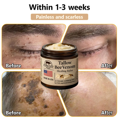 【Kojący】70% kojący】Nadaje się do skóry trądzikowej, zmarszczkowej i uszkodzonej (bez sterydów)