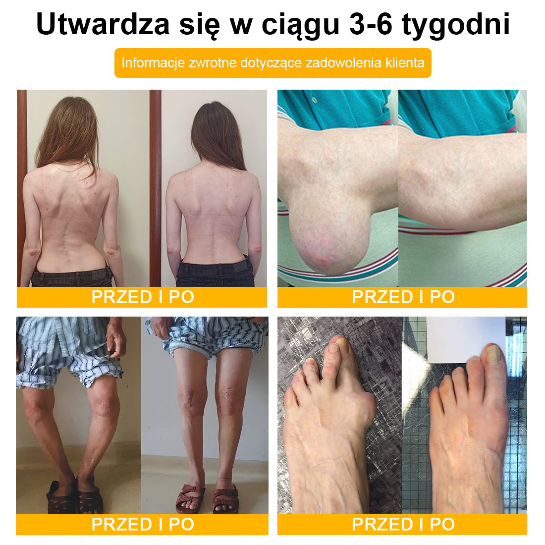 ArthroFree™ 𝑲𝒓𝒆𝒎 𝑳𝒆𝒄𝒛𝒏𝒊𝒄𝒛𝒚 𝒏𝒂 𝑩𝒐́𝒍 𝒊 𝑼𝒛𝒅𝒓𝒐𝒘𝒊𝒆𝒏𝒊𝒆 𝑲𝒐𝒔́𝒄𝒊 𝒛 𝑱𝒂𝒅𝒆𝒎 𝑷𝒔𝒛𝒄𝒛𝒆𝒍𝒊𝒎 (𝑺𝒑𝒆𝒄𝒋𝒂𝒍𝒏𝒊𝒆 𝒅𝒍𝒂 𝒐𝒔𝒐́𝒃 𝒔𝒕𝒂𝒓𝒔𝒛𝒚𝒄𝒉, 𝒛𝒂𝒍𝒆𝒄𝒂𝒏𝒚 𝒑𝒓𝒛𝒆𝒛 𝑨𝑨𝑶𝑺)