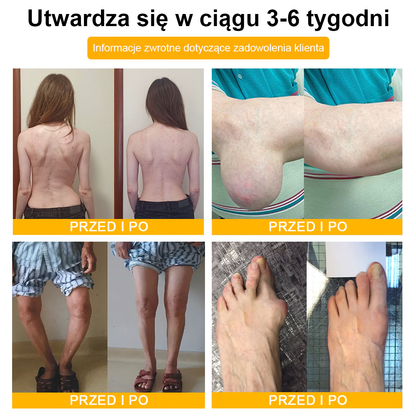 ArthroFree™ 𝑲𝒓𝒆𝒎 𝑳𝒆𝒄𝒛𝒏𝒊𝒄𝒛𝒚 𝒏𝒂 𝑩𝒐́𝒍 𝒊 𝑼𝒛𝒅𝒓𝒐𝒘𝒊𝒆𝒏𝒊𝒆 𝑲𝒐𝒔́𝒄𝒊 𝒛 𝑱𝒂𝒅𝒆𝒎 𝑷𝒔𝒛𝒄𝒛𝒆𝒍𝒊𝒎 (𝑺𝒑𝒆𝒄𝒋𝒂𝒍𝒏𝒊𝒆 𝒅𝒍𝒂 𝒐𝒔𝒐́𝒃 𝒔𝒕𝒂𝒓𝒔𝒛𝒚𝒄𝒉, 𝒛𝒂𝒍𝒆𝒄𝒂𝒏𝒚 𝒑𝒓𝒛𝒆𝒛 𝑨𝑨𝑶𝑺)