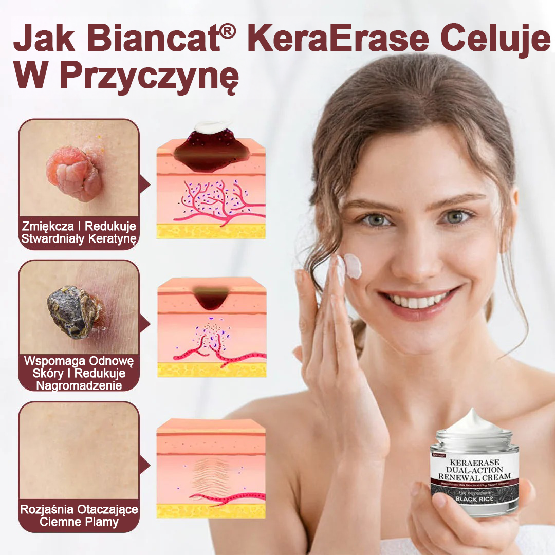 Krem regenerujący Biancat® KeraErase o podwójnym działaniu
