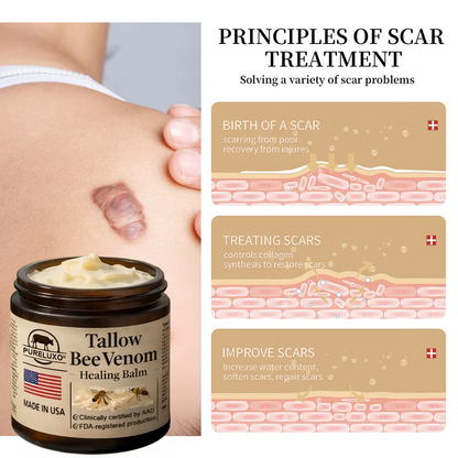 【Kojący】70% kojący】Nadaje się do skóry trądzikowej, zmarszczkowej i uszkodzonej (bez sterydów)