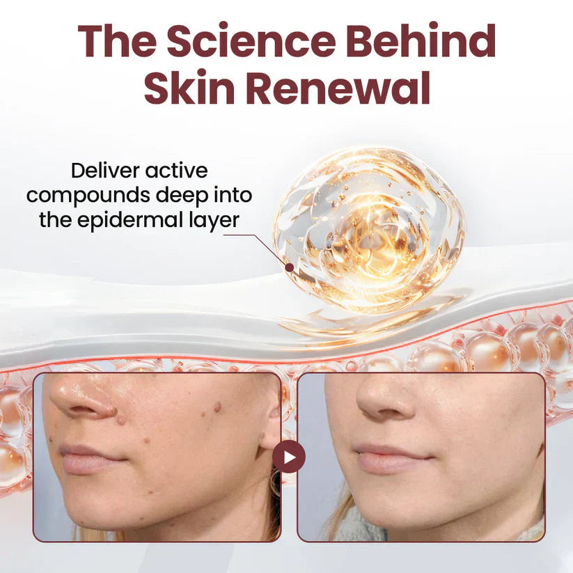 【Kojący】70% kojący】Nadaje się do skóry trądzikowej, zmarszczkowej i uszkodzonej (bez sterydów)