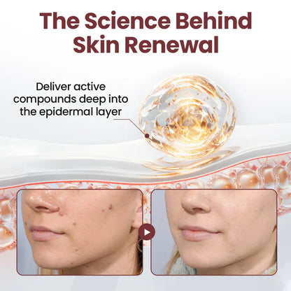 【Kojący】70% kojący】Nadaje się do skóry trądzikowej, zmarszczkowej i uszkodzonej (bez sterydów)