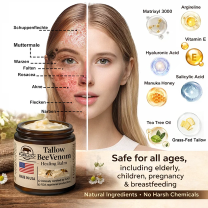 【Kojący】70% kojący】Nadaje się do skóry trądzikowej, zmarszczkowej i uszkodzonej (bez sterydów)