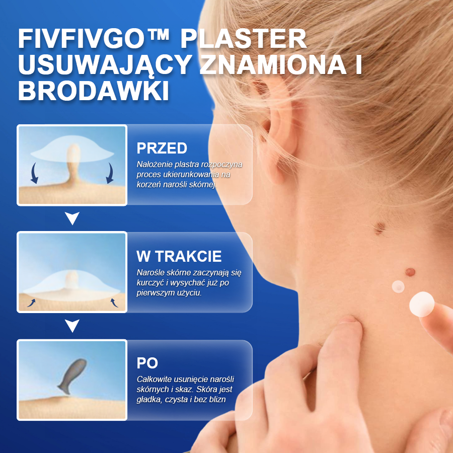Fivfivgo™ Plasterek na znamiona i brodawki usuwający narośl skórną