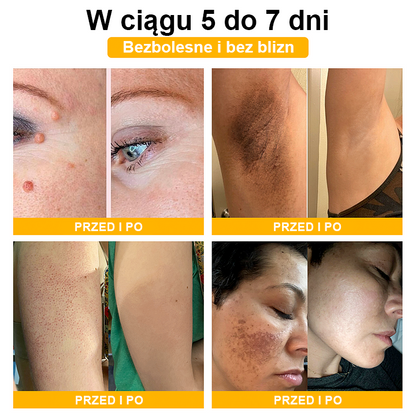 【🫧Płatność przy odbiorze🫧】Turonu™ leczniczy krem do skóry z jadem pszczelim (zalecany przez AAD)