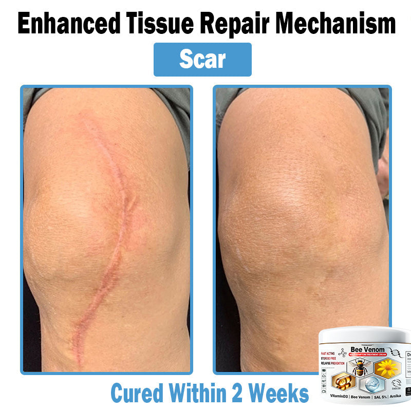 TOD𝐀HOF™🏅 Krem wielozadaniowy na bazie jadu pszczelego (👨‍⚕ZALECA NPF)