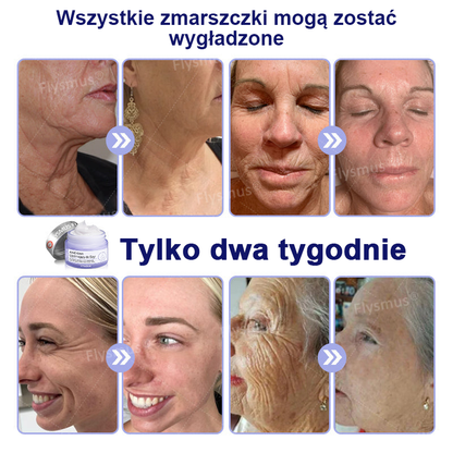 🌴🎁Wyprodukowane i wysłane z Australii - Flysmus® AH-8 Krem do napięcia i liftingu szyi - OSTATNI DZIEŃ 70% ZNIŻKI