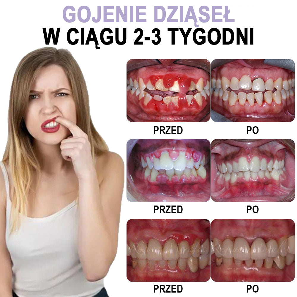✅Oficjalny sklep | Spray do pielęgnacji jamy ustnej Instant Smile™ Clove Oil 🧑🏼‍⚕️ Certyfikowany przez Niemieckie Stowarzyszenie Stomatologiczne 🍀