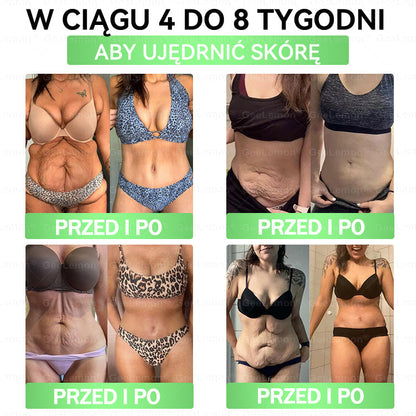 👩‍⚕️Oficjalny Sklep | 🎁 Pureluxo® 𝐆𝐥𝐮𝐦ase𝐭𝐢𝐝𝐞 𝟖 𝐰 𝟏 Smukły i Zdrowy Nano Plaster z Mikronakłuciami 🇵🇱(Tylko raz dziennie, widoczne zmiany już w 7 dni)✅ Na otyłość, 🅛🅞🅞🅢🅔 🅢🅚🅘🅝 wiotką skórę, cukrzycę, bezdech senny, problemy ze stawami i wiele więcej🎅🎄🎄🎄