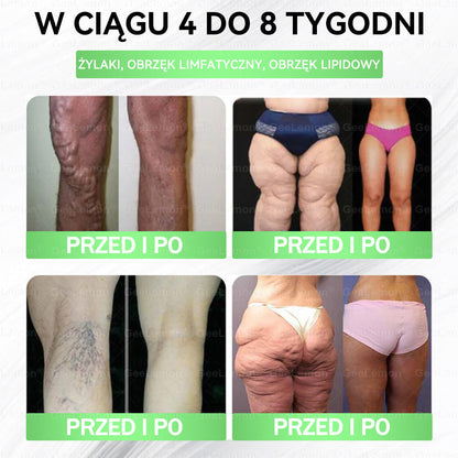👩‍⚕️Oficjalny Sklep | 🎁 Pureluxo® 𝐆𝐥𝐮𝐦ase𝐭𝐢𝐝𝐞 𝟖 𝐰 𝟏 Smukły i Zdrowy Nano Plaster z Mikronakłuciami 🇵🇱(Tylko raz dziennie, widoczne zmiany już w 7 dni)✅ Na otyłość, 🅛🅞🅞🅢🅔 🅢🅚🅘🅝 wiotką skórę, cukrzycę, bezdech senny, problemy ze stawami i wiele więcej🎅🎄🎄🎄