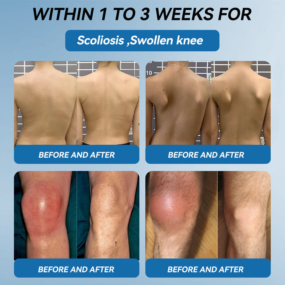 𝖯𝗂𝖼𝗱𝗈® BPC-157 Krem regenerujący stawy 🦴 Skutecznie łagodzi artretyzm, neuropatię, reumatyzm, kontuzje sportowe i wiele więcej 👍