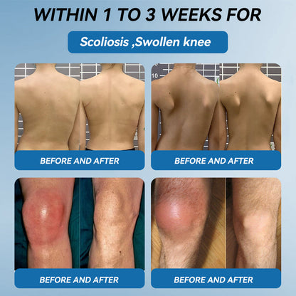 𝖯𝗂𝖼𝗱𝗈® BPC-157 Krem regenerujący stawy 🦴 Skutecznie łagodzi artretyzm, neuropatię, reumatyzm, kontuzje sportowe i wiele więcej 👍