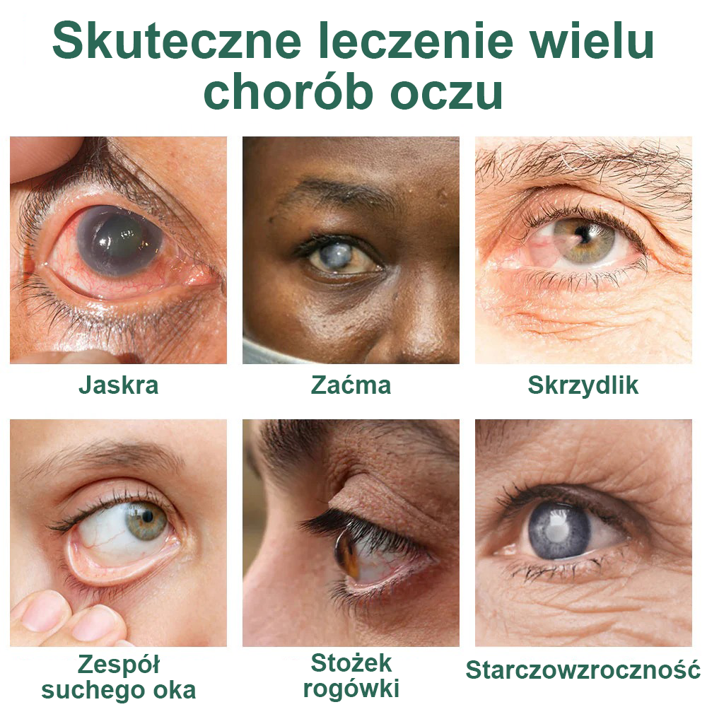 👩‍⚕️Serum kropli do oczu Ourlyard® Nano ✅Zatwierdzone przez FDA (nadaje się na starczowzroczność, zespół suchego oka, jaskrę i zaćmę) 👀