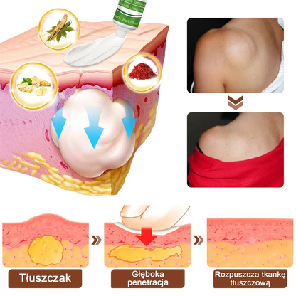 Maść łagodząca Cvreoz® Lipoma Cure