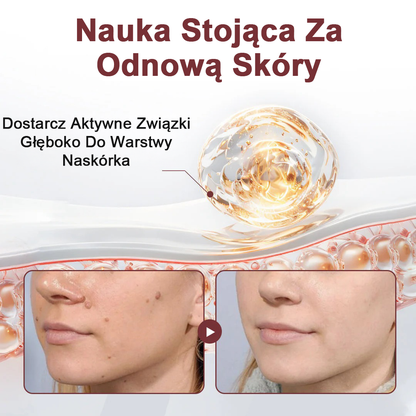 Krem regenerujący Biancat® KeraErase o podwójnym działaniu