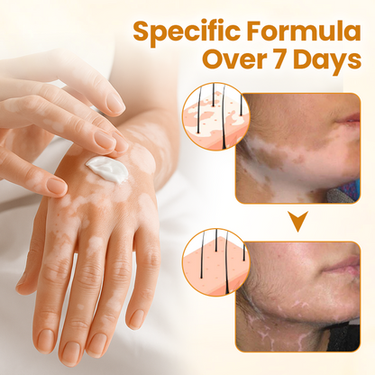 Krem z jadem pszczelim Oveallgo® VitiClear Pro