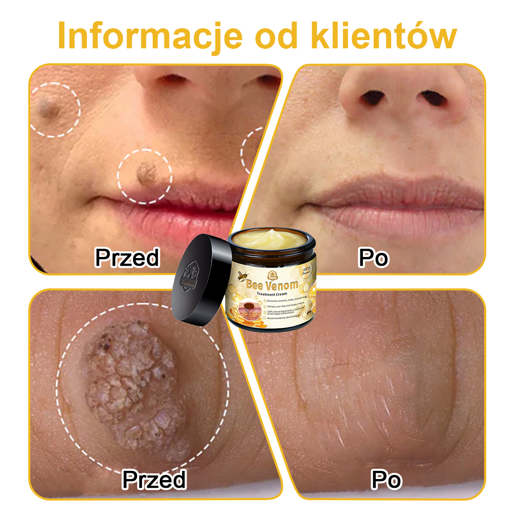 【🫧Płatność przy odbiorze🫧】Turonu™ leczniczy krem do skóry z jadem pszczelim (zalecany przez AAD)