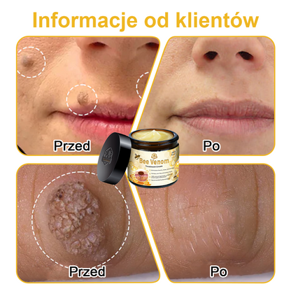 【🫧Płatność przy odbiorze🫧】Turonu™ leczniczy krem do skóry z jadem pszczelim (zalecany przez AAD)