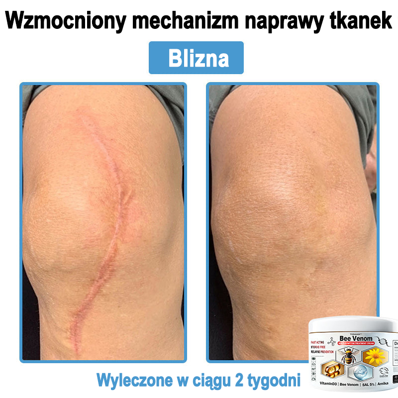 TOD𝐀HOF™🥑 Krem do wielosymptomowej pielęgnacji skóry z jadem pszczelim (ACDRECOMMENDS)