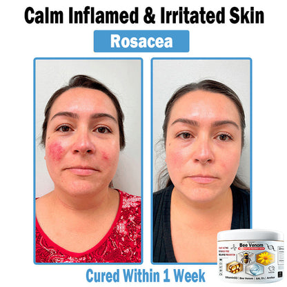 TOD𝐀HOF™🏅 Krem wielozadaniowy na bazie jadu pszczelego (👨‍⚕ZALECA NPF)