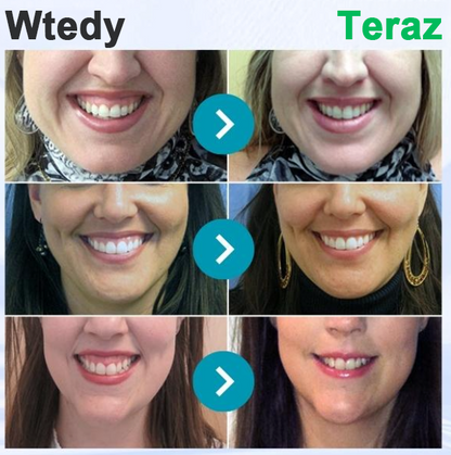 🥇Oficjalny sklep Furzero™ Focussmile Bee Venom Treatment Oral Powder 🦷 (zalecany przez ADA)