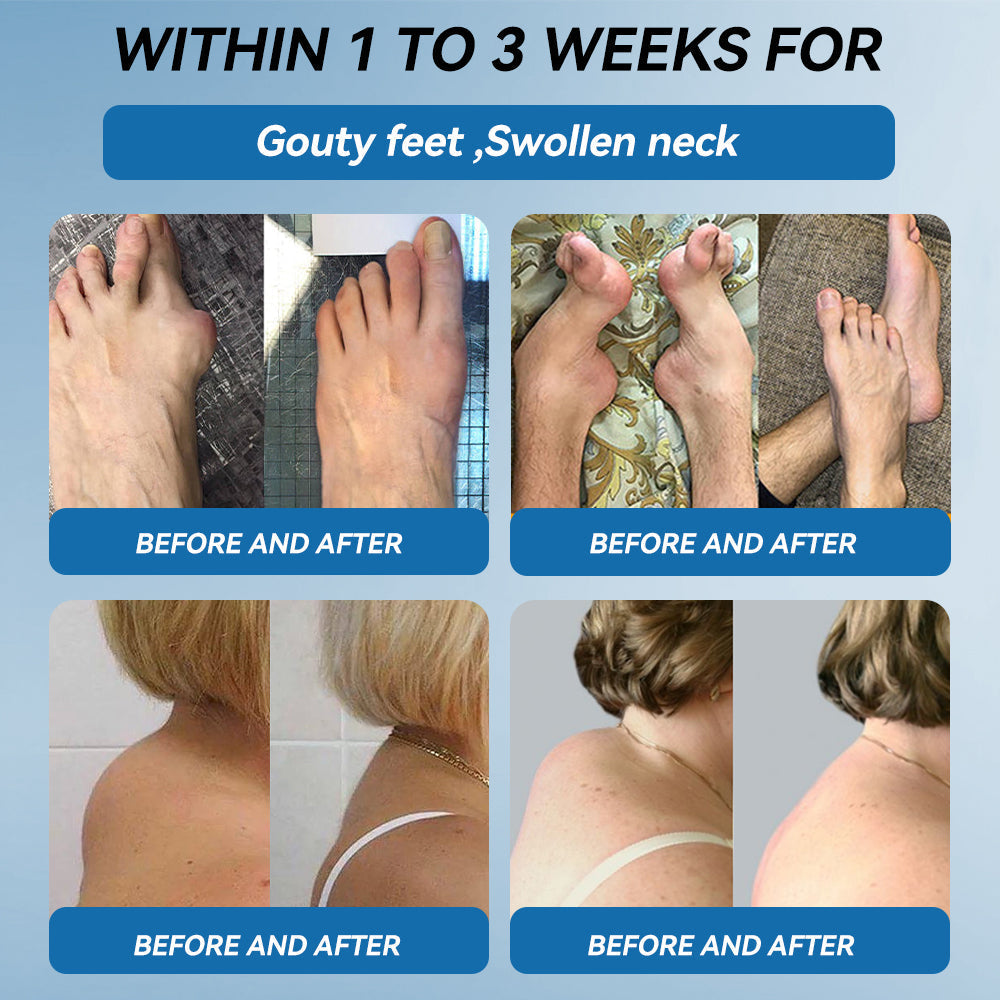 𝖯𝗂𝖼𝗱𝗈® BPC-157 Krem regenerujący stawy 🦴 Skutecznie łagodzi artretyzm, neuropatię, reumatyzm, kontuzje sportowe i wiele więcej 👍