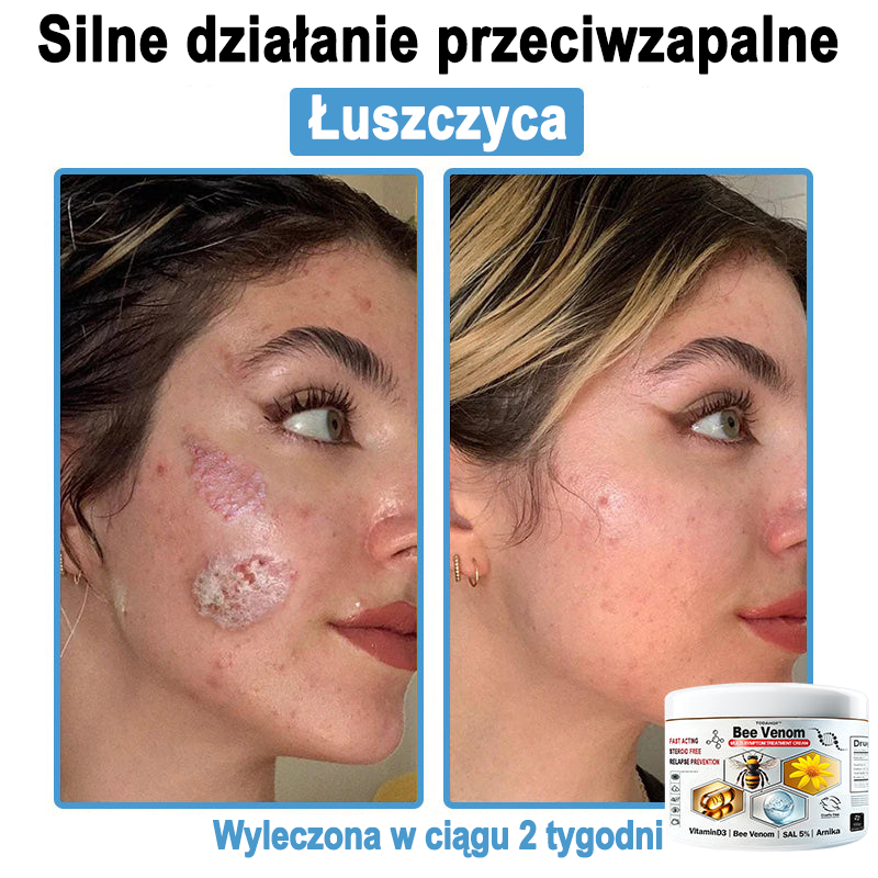 TOD𝐀HOF™🥑 Krem do wielosymptomowej pielęgnacji skóry z jadem pszczelim (ACDRECOMMENDS)