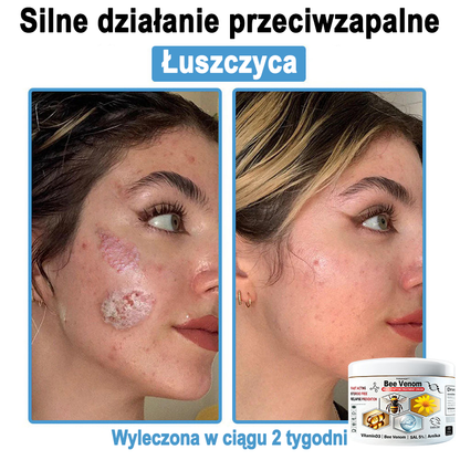 TOD𝐀HOF™🥑 Krem do wielosymptomowej pielęgnacji skóry z jadem pszczelim (ACDRECOMMENDS)