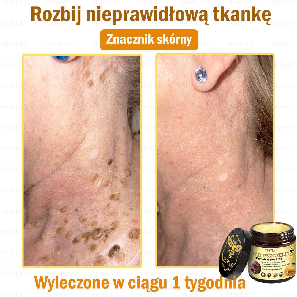 VLSVLS™ Krem Komprehensywny z Jadami Pszczół 🇺🇸 Rekomendowany przez Dermatologów