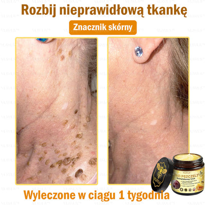 VLSVLS™ Krem Komprehensywny z Jadami Pszczół 🇺🇸 Rekomendowany przez Dermatologów