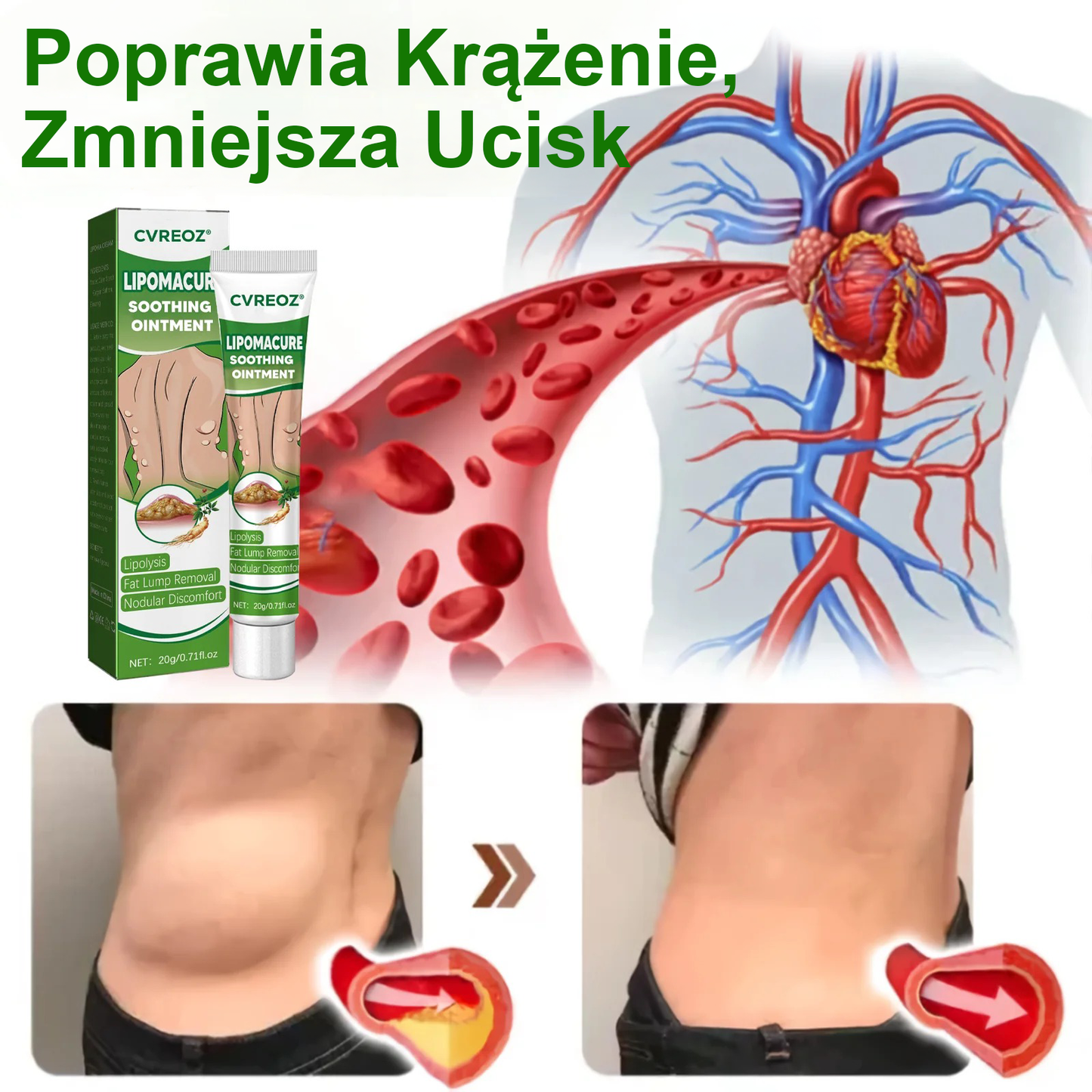 Maść łagodząca Cvreoz® Lipoma Cure